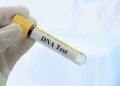 Biaya Tes DNA yang Dijalani, Ini Kisaran Harganya di Indonesia