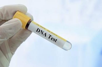 Biaya Tes DNA yang Dijalani, Ini Kisaran Harganya di Indonesia