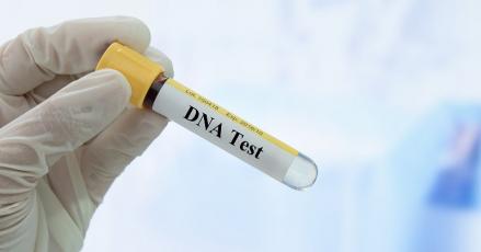 Biaya Tes DNA yang Dijalani, Ini Kisaran Harganya di Indonesia